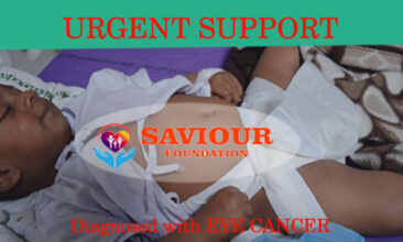 Virat Support Eye Cancer