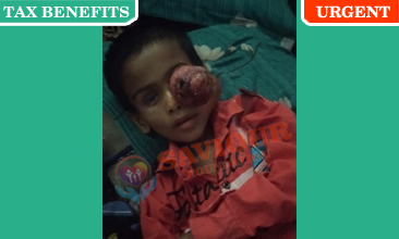 Abid 4Yrs old Eye Cancer